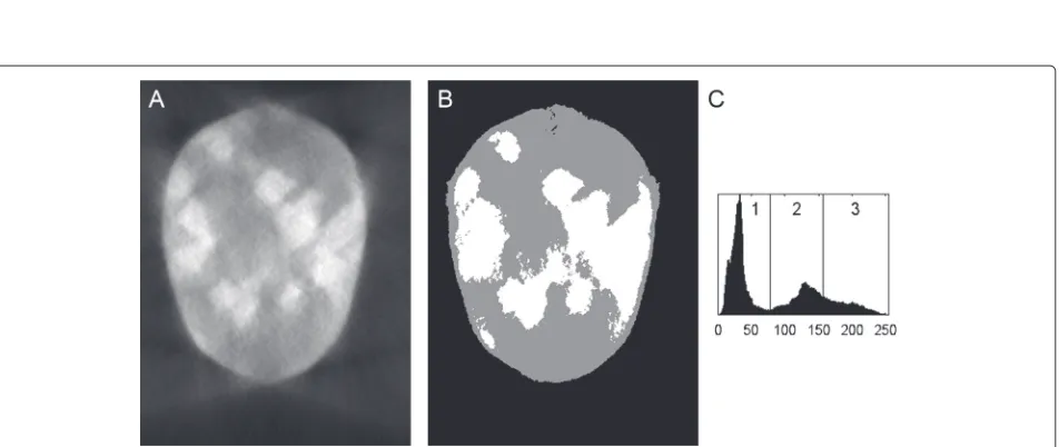 Fig. 5 Missing wedge reconstruction, processed with NAD.reconstruction (( a A WBP reconstruction of aligned, noiseless projections with a 28 ° missing wedge.b The reconstruction from (a) but processed with NAD