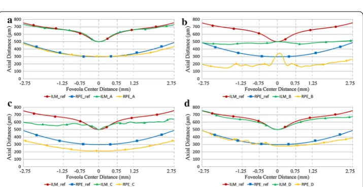 Fig. 9 The results of retinal boundary extraction in OCT images. After the preprocessing of standardization responding to the four original images in Fig