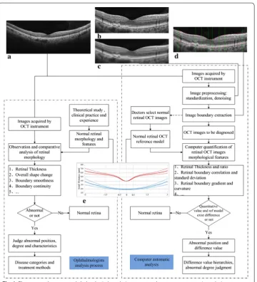 Fig. 1 The contrast between ophthalmologist’s analysis process and computer automatic analysis process