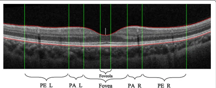 Table 2 Normal macular measure thickness and reference model quantitative values (µm; mean ± standard deviations)