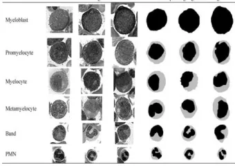 Fig. 1. Cell samples and corresponding manually segmented images in the myelocytic or granulocytic series