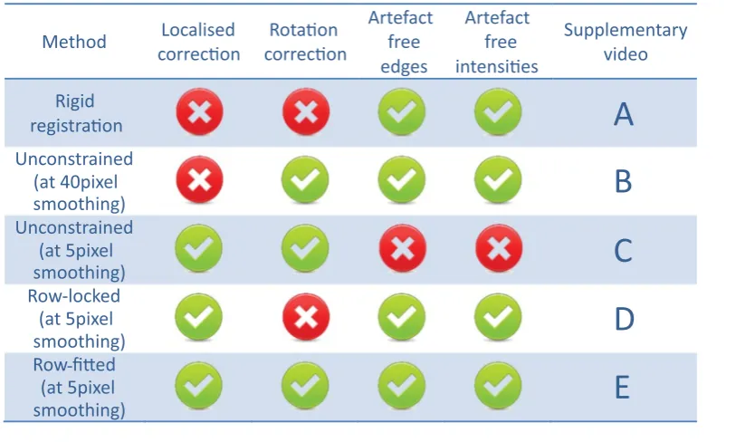Table 1 Performance evaluation of the rigid and non-rigid registration options discussed in the text