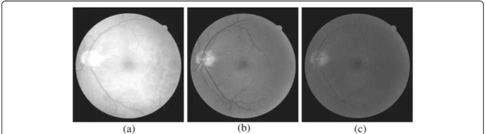 Figure 1 Sample retinal fundus images and manual segmentations. A pathological image (of size 640 × 480 pixels) from our own dataset([2,19]) given in (a), a non-pathological image (of size 565 × 584 pixels) from the DRIVE dataset ([3]) given in (b), the manual segmentation imageof (a) given in (c), and the manual segmentation image of (b) given in (d).
