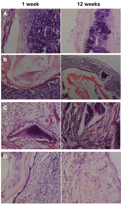 Figure 1 hematoxylin and eosin staining showing (A) transplanted group, (B) stent group, (C) non-Rna interference group, and (D) Rna interference group.Note: Magnification 10×.