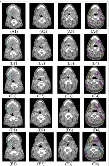 Figure 5 Comparison of results from the image registration methods with and without usinglandmark correspondence