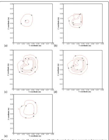 Figure 5 (a), (b), (c), (d) and (e) show with blood vessel structure present and temperatureThe applied absorbed power distributions are the identical optimized power distributions shown in Figs