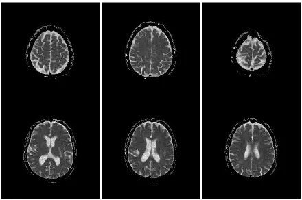 Figure  1. Sample Images of real brain MRI: Real Dataset I, Real Dataset II. 