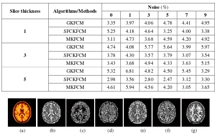 Table-4.Value of DB index for simulated brain MRI.