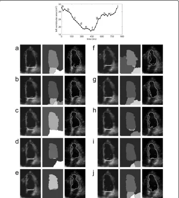 Figure 7 Image segmentation results in ten temporal frames along a complete cardiac cycle