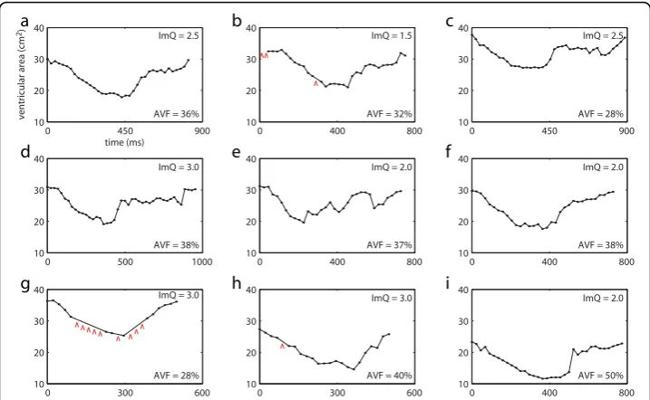 Figure 8 Measured AVCs for nine subjects. Red arrows in (b), (g), and (h) indicate temporal frames inwhich the automatic segmentation failed