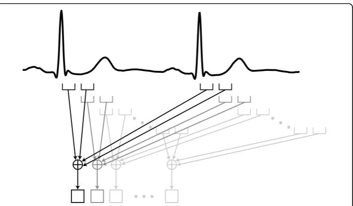 Figure 2 Time-averaging process. Four images from two consecutive cardiac cycles are averaged
