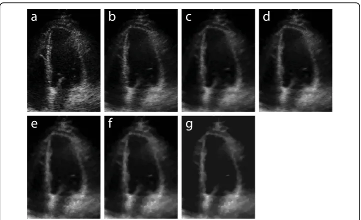 Figure 3 Step-by-step preprocessing resultswavelet denoising; (d) after edge enhancement; (e) after morphological closing and opening (disk radius =1); (f) after morphological closing (disk radius = 3); (g) after homotopy modification