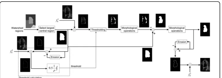 Figure 4 Step-by-step segmentation results. (a) Preprocessed image with atrioventricular barrier; (b)after watershed segmentation; (c) watershed contour; (d) corrected contour.