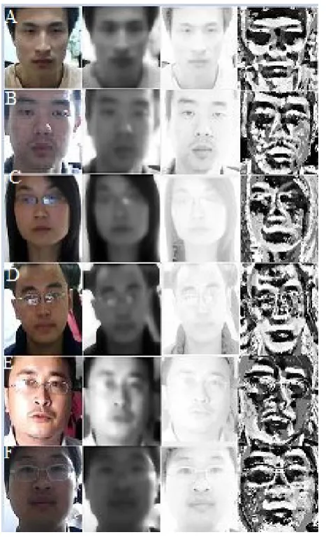 Figure 6 : (A), (C), (E) are the real images and (B), (D), 
