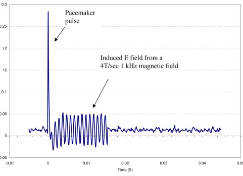 Figure 10Time domain plot of the E-field at the distal tip of a pacemaker lead connected to a pulse generatorTime domain plot of the E-field at the distal tip of a pacemaker lead connected to a pulse generator.