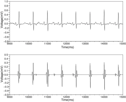 Figure 2Catching the time positions of the QRS complexesCatching the time positions of the QRS complexes