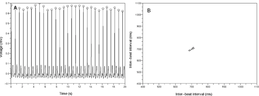 Figure 3The example of building a Poincaré plotThe example of building a Poincaré plot
