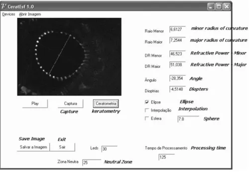 Figure 5One of the software's screens used for our own control - it is not presented to the surgeonOne of the software's screens used for our own control - it is not presented to the surgeon.