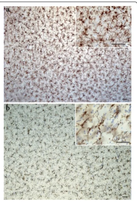 Figure 1 Distribution of ionized calcium binding adaptor moleculealigned to myelinated tracts in the white matter1 (IBA1)-immunoreactive (IR) cells in the gray and white matterhuman dorsal anterior cingulate cortex (dACC) counterstainedwith cresyl violet