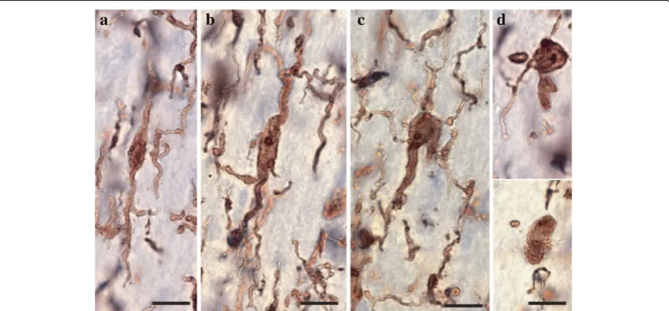 Figure 3 Four main phenotypes represent the population of resident IBA1-IR cells in human dACC white matter