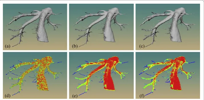 Figure 9 Comparison of triangle quality for an aorta tree. Surface model generated by the MC (a),MPU-based method (b), SS-based method (c) and our method (d)