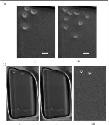 Figure 1 Background estimation. (a) Two unprocessed blood stem cell images: (i) Frame 1