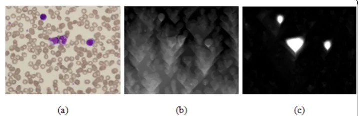Figure 6 Energy map comparison: (a) original image (b) energy map using only gradient magnitude,and (c) energy map using saliency strength of SSM.