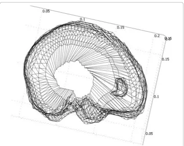 Figure 2 For creating the 3D model, the slices that are near the craniotomy surfaces have higherresolutions than the slices far from the surface
