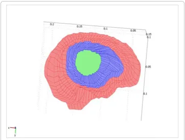 Figure 6 For both models, there are conditions for the force variable (F). The value of F for the greensurface (the center of the exposed surface) is fixed, for the blue surface (the remaining exposed surface) isunconstrained, and for the red surface (unexposed surface) is zero.