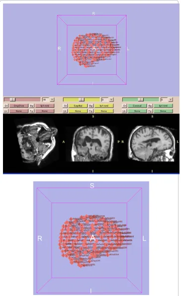 Figure 7 Illustration of using the 3D-Slicer software for manual selection of the landmarks byexpert radiologist