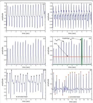Figure 8 Heart rate calculationDetermination of the threshold level and masking ofefficiency of the proposed heart rate determination technique and the results of the proposed technique