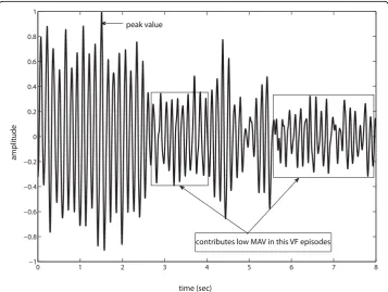 Figure 2 Choice of analysis window. Effect of choice of 2-s analysis window duration on MAV.