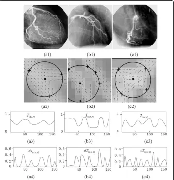 Figure 4 Using the circular pattern detector to characterize the vessel structures, in the cases withcorresponding magnitude profiles of the first-order derivativebifurcation, paralleling, and crossing patterns