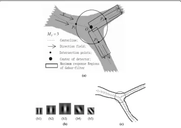 Figure 5 The feature integration, Gabor masks, and structure detection near artery bifurcation2,