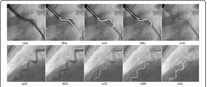 Figure 8 Comparison of the results of vessel-tracking using the PTO based on different continuityPTO based onterms