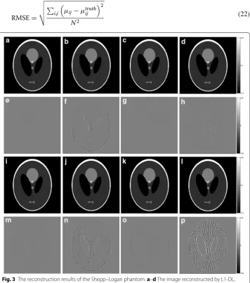 Fig. 3 The reconstruction results of the Shepp–Logan phantom. a–d The image reconstructed by L1-DL, ADSIR, GPBB and SART respectively with 120 scanning views data; e–h the difference between the recon-structed image (a–d) and the original image (OI); i–l the image reconstructed by L1-DL, ADSIR, GPBB and SART respectively with 60 scanning views data; m–p the difference between the reconstructed image (i–l) and the original image (OI)