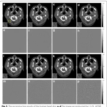 Fig. 5 The reconstruction results of the human head slice. a–d The image reconstructed by L1-DL, ADSIR, GPBB and SART respectively with 180 scanning views data; e–h the difference between the reconstructed image (a–d) and the original image (OI); i–l the image reconstructed by L1-DL, ADSIR, GPBB and SART respectively with 90 scanning views data; m–p the difference between the reconstructed image (i–l) and the original image (OI)