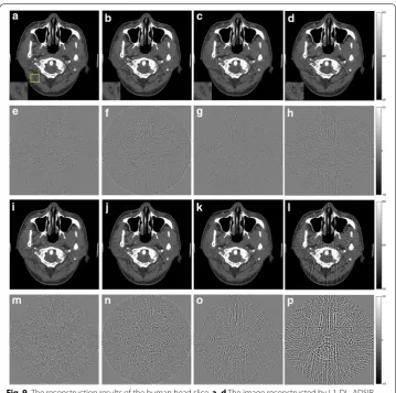 Fig. 9 The reconstruction results of the human head slice. a–d The image reconstructed by L1-DL, ADSIR, GPBB and SART respectively with 180 scanning views data simulated by 2 million photons; e–h the difference between the reconstructed image (a–d) and the original image (OI); (i–l) the image reconstructed by L1-DL, ADSIR, GPBB and SART respectively with 90 scanning views data simulated by 2 million photons; m–p the difference between the reconstructed image (i–l) and the original image (OI)