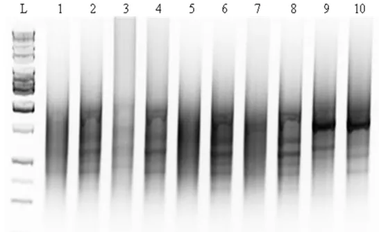 Figure 3:  Suppression subtractive hybridization. Lane L= HiLo DNA ladder, Lane 1= Ovicell-bearing (OB)-Forward subtracted cDNA, Lane 2= OB-Forward unsubtracted tester cDNA, Lane 3= OB-Reverse subtracted cDNA, Lane 4= OB-Reverse unsubtracted tester cDNA, L