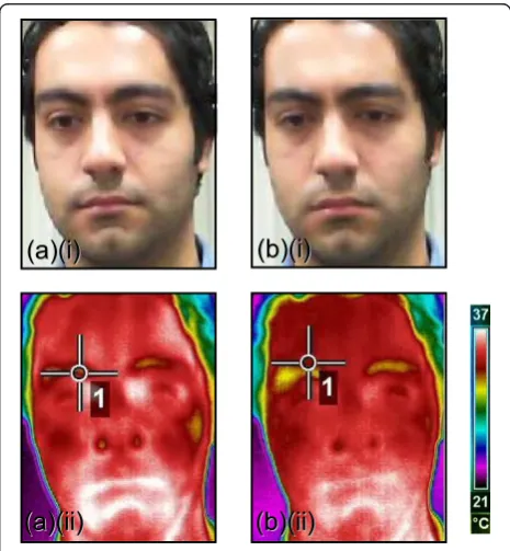 Figure 3.Facial regions were extracted from each frame of a