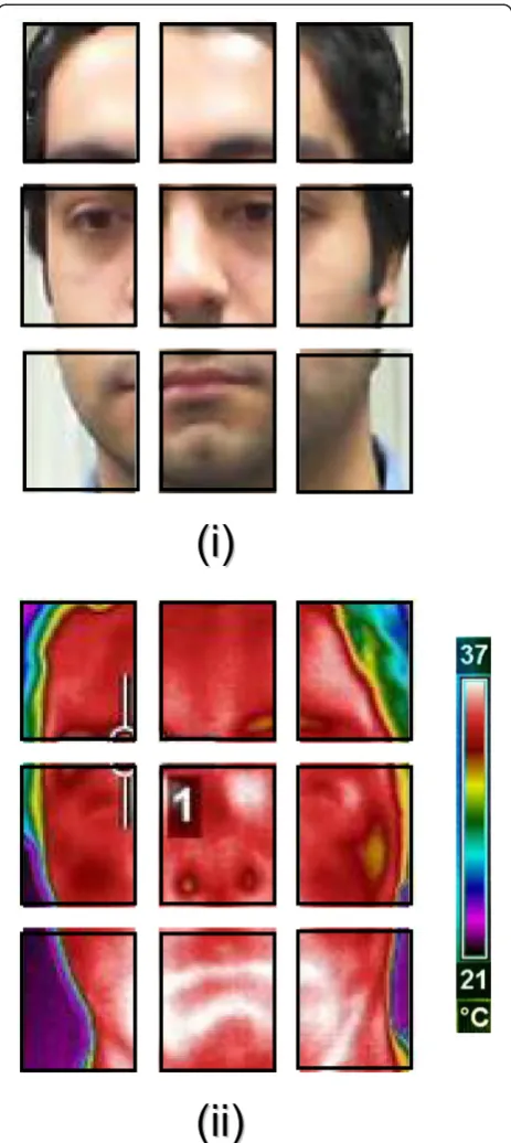 Figure 5 The facial region in Figure 4a segmented into 3 × 3blocks. (i) Blocks of the frame in the visual spectrum