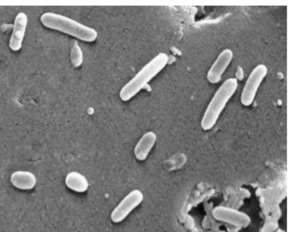 Figure 2: Scanning electron micrograph of                                                             Pseudomonas aeruginosa-(CDC).(Todar, 2008)  