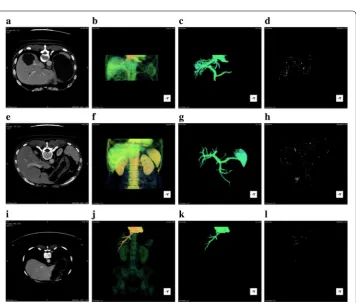 Fig. 4 a The result of original CUDA-kFOE, b the result of improved CUDA-kFOE
