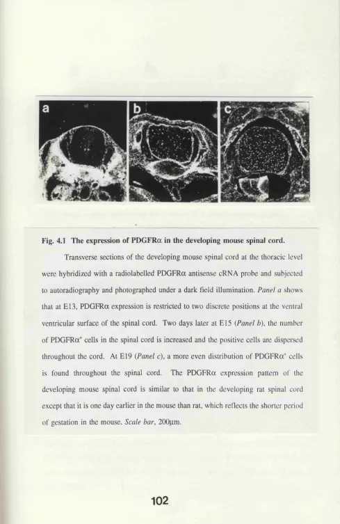 Fig. 4.1 The expression of PDGFRa in the developing mouse spinal cord.