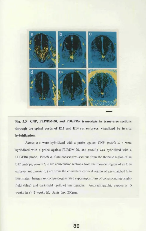Fig. 3.3 CNP, PLP/DM-20, and PDGFRa transcripts in transverse sections 