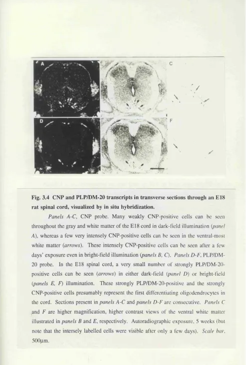 Fig. 3.4 CNP and PLP/DM-20 transcripts in transverse sections through an E18 