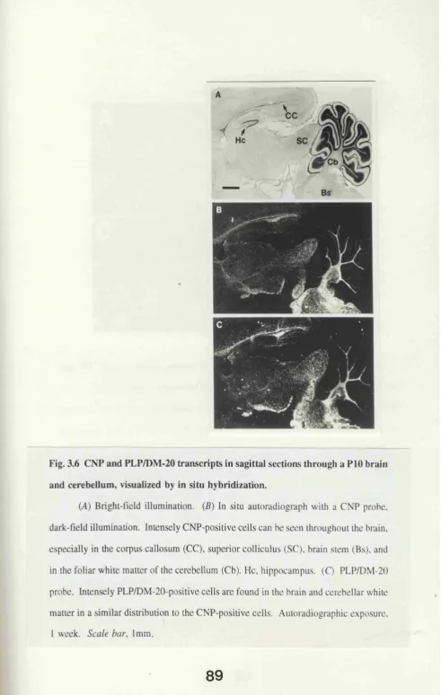 Fig. 3.6 CNP and PLP/DM-20 transcripts in sagittal sections through a PIG brain 