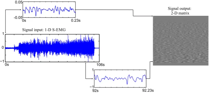 Fig. 1 Example of a one-dimensional noninvasive electromyographic (SEMG) record rearranged into a two-dimensional array
