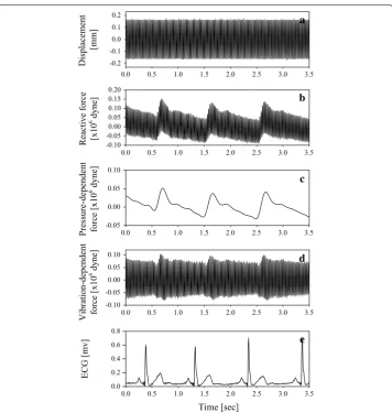 Fig. 5 Typical time course of (a) the vibrator signal with 0.15 mm displacement and 40 Hz vibration, b the reactive force signal, c the arterial pressure‑dependent force without the vibrator effect, d the sinusoidal vibration‑dependent force, e the electrocardiogram (ECG) signal