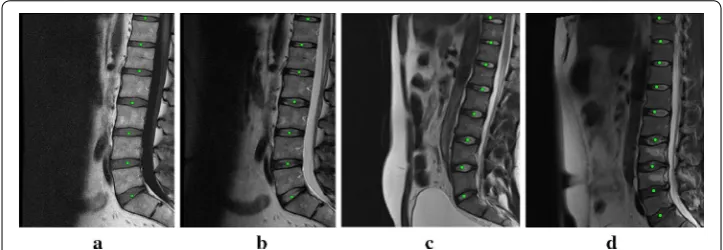 Fig. 9 The localization results of the SpineWeb database. a, b and c, d are from different databases and subjects